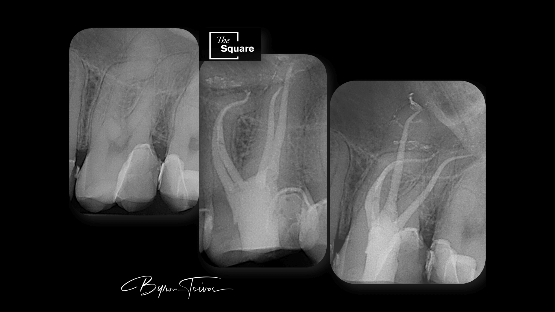 Curved Roots - Case 6